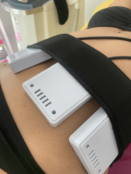 Lipolaser – bezbolno oblikovanje tela pomoću laserske tehnologije